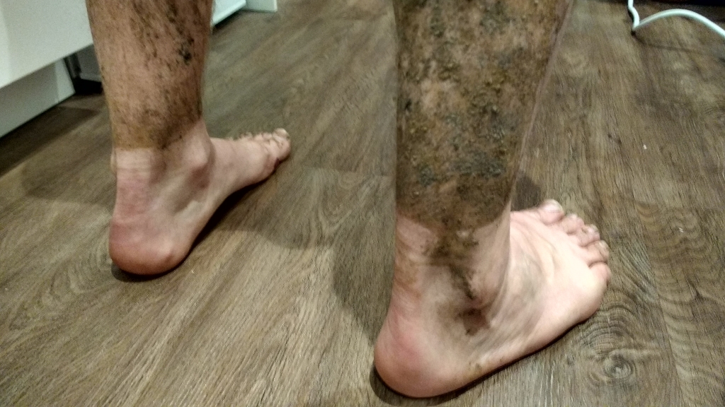 My feet after the run: muddy with the odd blister but in generally pretty good nick